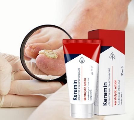 Keramin apteka - Gdzie znaleźć Keramin w Polsce? Rozwiązanie dla problemu zdrowia